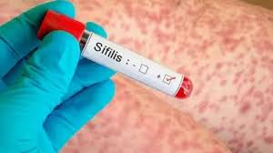 Alarmante crecimiento de sífilis entre adolescentes y jóvenes mujeres