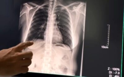 El 40% de los pacientes que accedieron al Consultorio de Cesación Tabáquica dejaron de fumar