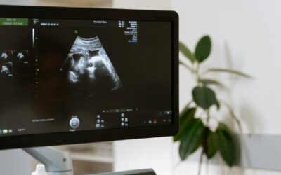 Los obispos de EE. UU. recurren el fallo que les obliga a facilitar el aborto en sus instituciones